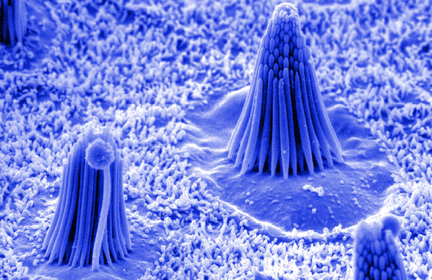 Colorized scanning electron micrograph of the inner ear’s sensory surface, showing several tall, cone‑shaped bundles of hair‑like cilia rising from a textured field of much shorter projections. The scene is tinted blue. Each main bundle forms a tight cluster of parallel rods, with one bundle centrally prominent and others smaller in the foreground and background, illustrating the tiny hair cells essential for hearing and balance.
