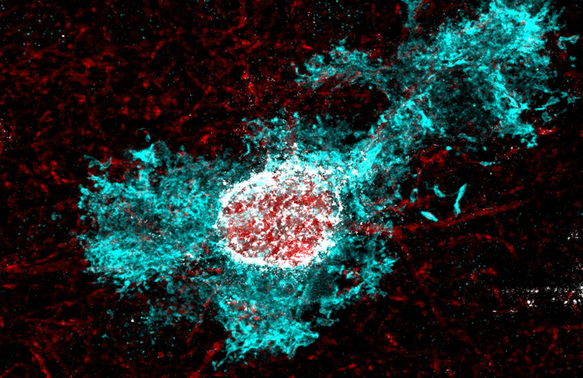 Fluorescence microscope image of a single astrocyte brain cell, showing a bright red oval cell body surrounded by a cloud of branching, web-like turquoise extensions against a dark, speckled red background. Credit: Greenberg Lab.